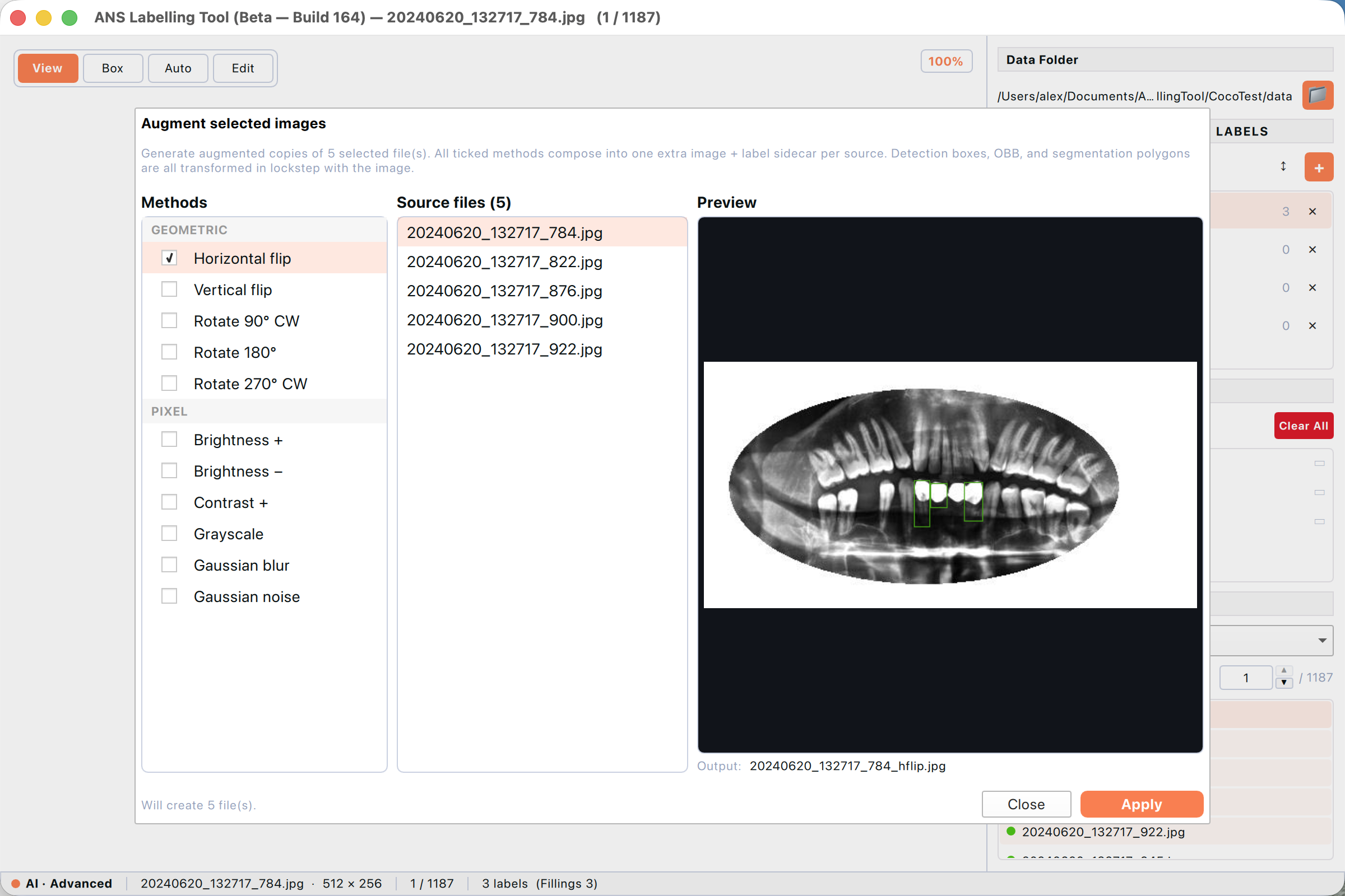 The Augment dialog with Horizontal flip ticked. Three panes — Methods (left), Source files (centre), live Preview (right) showing the flipped image with the green Fillings labels mirrored correctly. The Output filename below the preview previews the suffix chain.